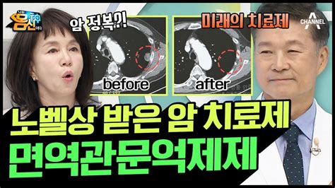 나는몸신이다 폐암 4기 환우도 억제제 3번 만에 완치완전 관해 가능 암 면역항암제 나는 몸신이다 431 회