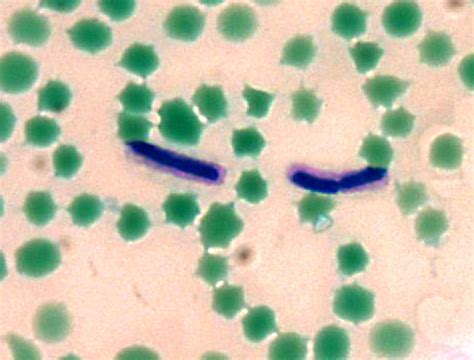 Free picture: bacillus anthracis, mfadyean, capsule, stain, grown ...