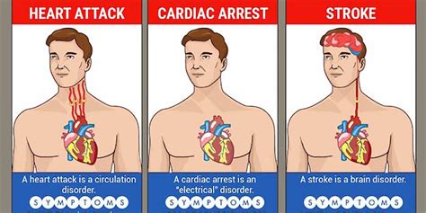 Understanding Cardiac Arrest Heart Attack And Stroke