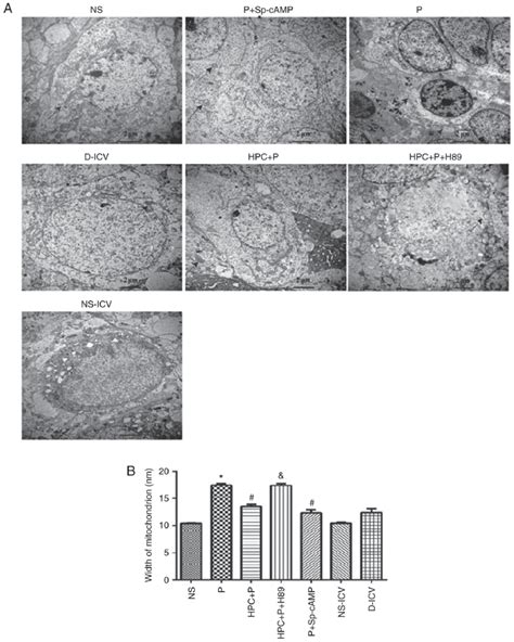 Examination Of The Hippocampal CA1 Region By Transmission Electron