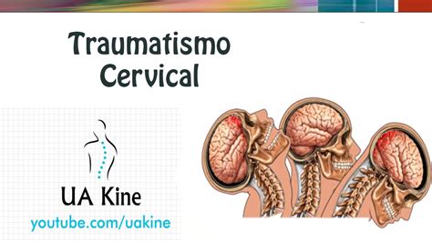 Traumatismo Raquimedular Cuidados De Enfermagem Edukita