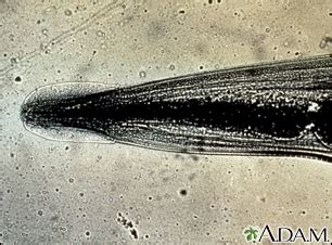 Pinworm Under Microscope