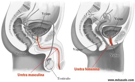 La Uretritis En Hombres S Ntomas Causas Y Tratamientos