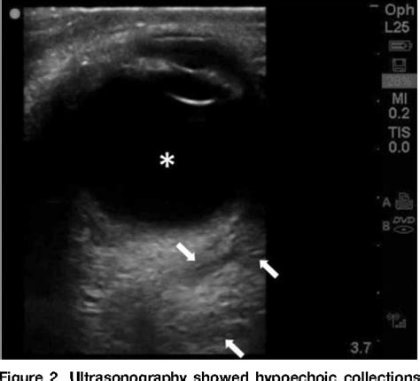 Figure From Visual Diagnosis In Emergency Medicine Early Detection Of