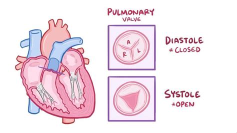 Pulmonary valve disease: Video, Causes, & Meaning | Osmosis