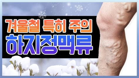 헬스인뉴스 건강멘토 겨울철 특히 조심해야 하는 하지정맥류 Youtube