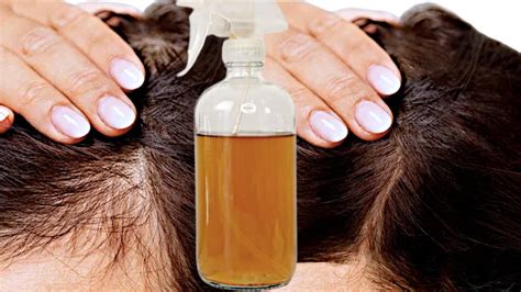 Solo 3 Ingredientes Y Tu Cabello No Dejara De Crecer 😱 DetÉn La CaÍda