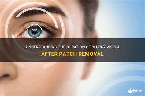 Understanding The Duration Of Blurry Vision After Patch Removal Medshun