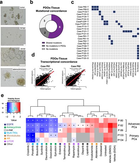 Patient Derived Organoids Pdo Of Multiple Pca Cases Preserve Download Scientific Diagram