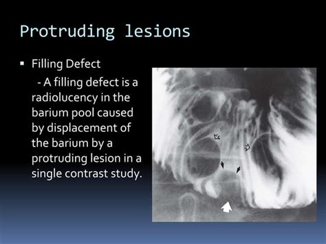 Barium enema procedure and patterns