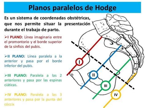 Planos de Hodge | Obstetricia, Gineco obstetricia, Obstetricia y ...