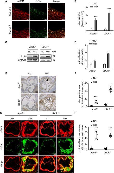 Vascular smooth muscle cell c-Fos is critical for foam cell formation ...