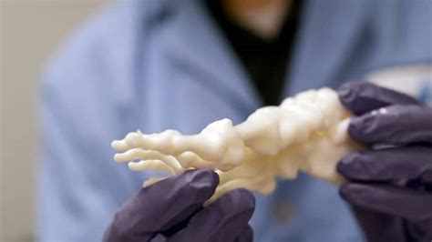 3d Printing Ti6al4v Orthopaedic Implants As Easy As Counting 1 2 3 Video 3dheals