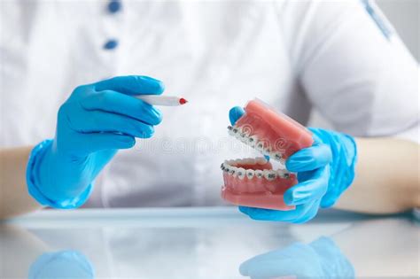 Doctor Orthodontist Showing Model Of Human Jaw With Wire Braces