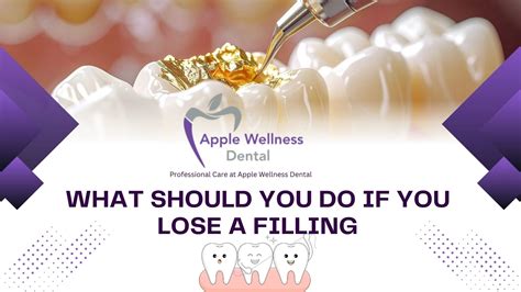 What To Do If You Lose A Filling
