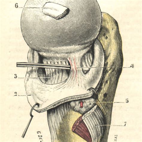 Synovial Folds Of The Hip Joint After Anseroff A Anterior Fold B