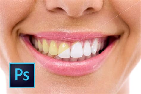 Clarear Dentes No Photoshop Tutorial Completo Passo A Passo