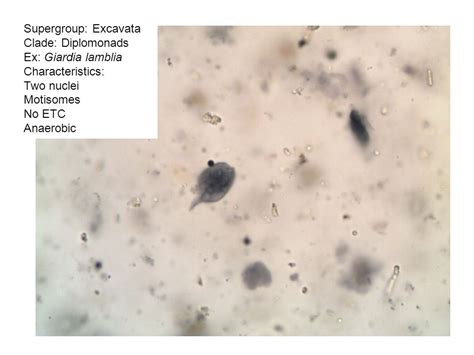 Giardia Lamblia Slide