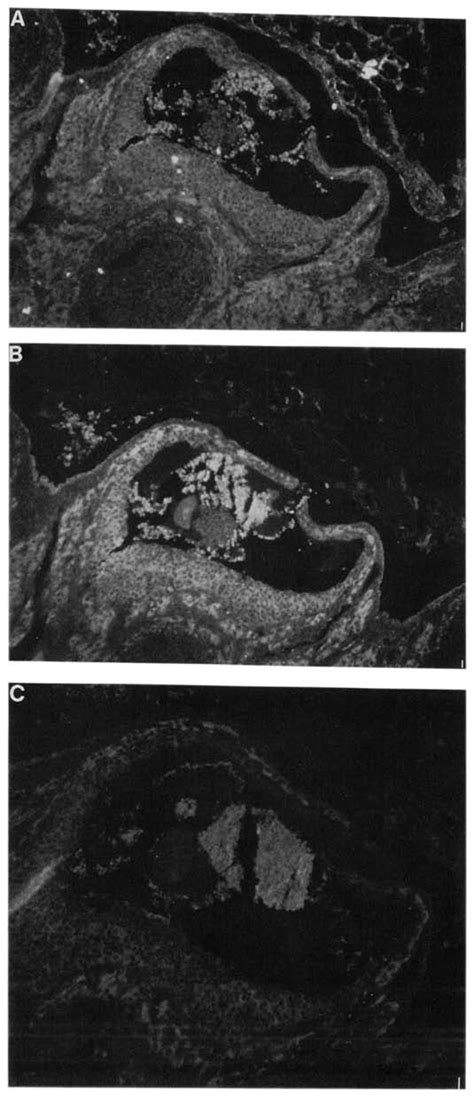 Immunohistochemical Localization Of IL 1R Tl IL 13 And Macrophages In