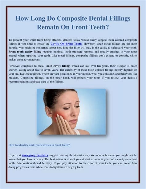 Ppt How Long Do Composite Dental Fillings Remain On Front Teeth