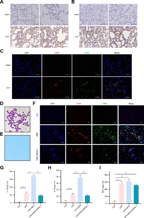 Figure From Neutrophil Extracellular Traps Induce Alveolar Macrophage