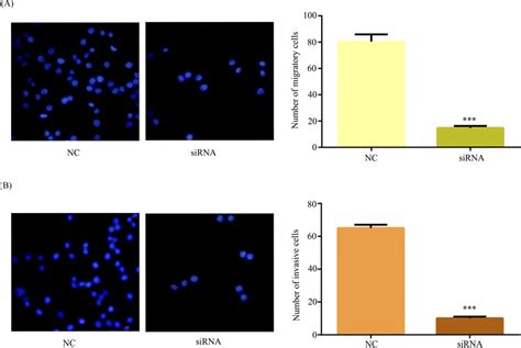 Downregulated Of Hsa Circ 101882 Inhibited MGC803 Cell Migration And