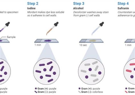 Gram Staining Principle Procedure Results Gram Positive Vs Gram