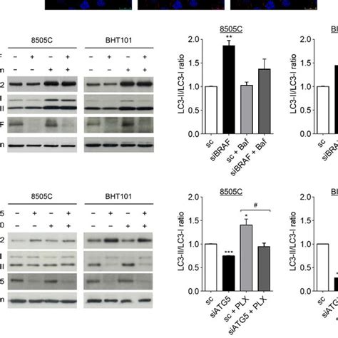 V E Braf Inhibition Induces Autophagy In Thyroid Cancer Cells A