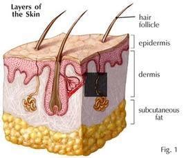 What Causes Subcutaneous Fat?: Chrysolite Aesthetics : Aesthetic ...