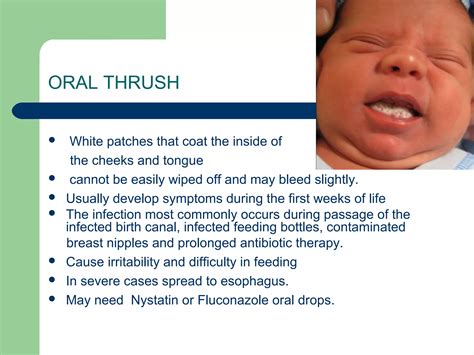 Common Neonatal Problems Ppt