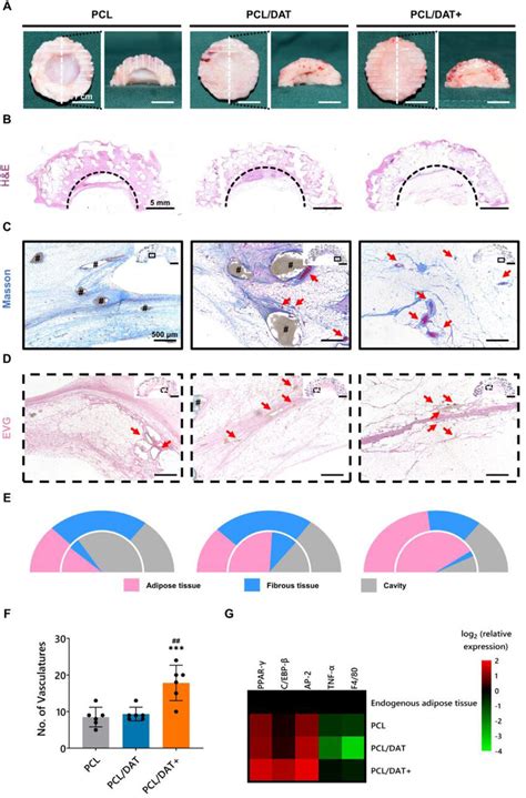 Long Term Months Outcomes Of Implantation In Vivo A