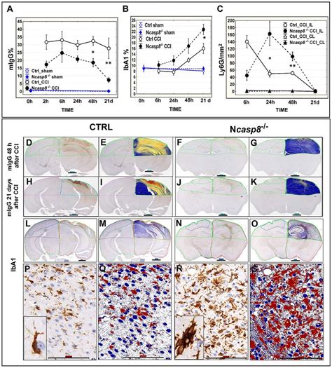 Immunohistochemical Assessment Of Migg Extravasation Microglia