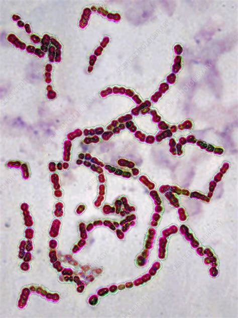 Streptococcus Pyogenes Infection