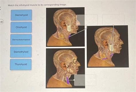 Solved Match The Infrahyoid Muscle To Its Corresponding Chegg