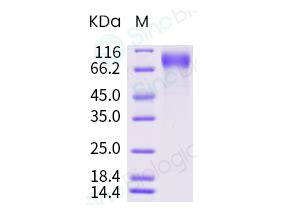 Recombinant Human Osteoactivin Gpnmb Protein H H Sino Biological