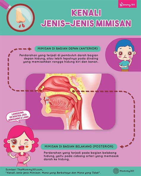 Penyebab Gejala Dan Cara Mengatasi Mimisan Mommy 101