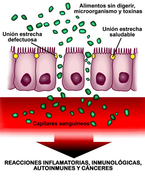 Disbiosis Y El S Ndrome Del Intestino Permeable Equisens