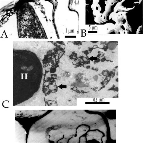 Electron Microscopy Micrographs Demonstrating The Hostpathogen