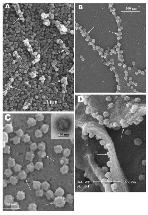 Electron Microscope Sars Corona Virus – Site Title