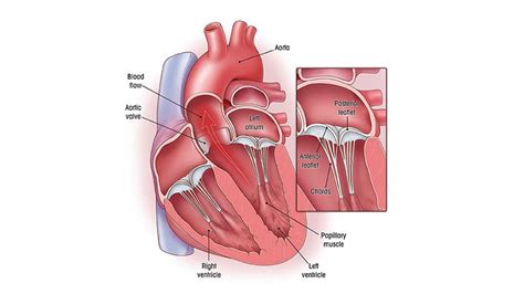 Mitral Valve Leaflet Anatomy