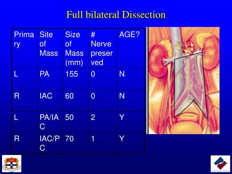 Ppt The Role Of Rplnd In The Management Of Testis Cancer Powerpoint Presentation Id 1811182