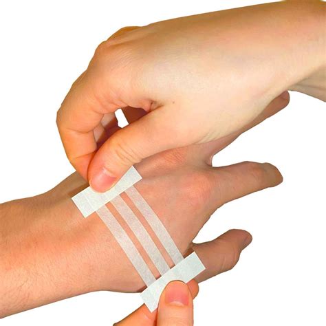 Sterile Adhesive Wound Closure Strips 6cmx75cm Box Of 150 3 Strips Per Sachet Medicaldressings