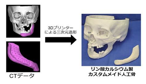 東大病院3Dプリンターを使った人工骨を来年にも実用化 デジタルものづくりの情報サイトメイカーズラブ