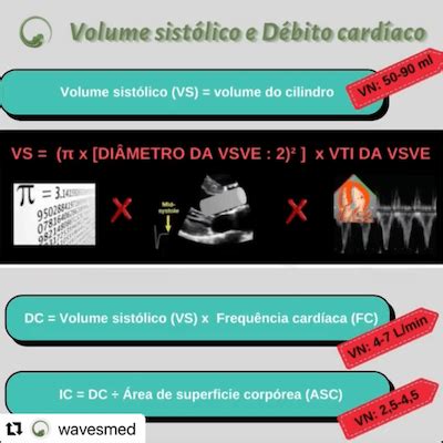 Wavesmed Karen Saori Fun O Ventricular Esquerda Pelo Doppler