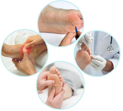 Foot Injury Feet Treatment Podiatry Laser Therapy Wound Care