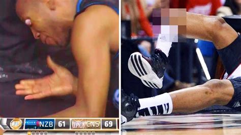 Worst Nba Basketball Injuries Of All Time Youtube