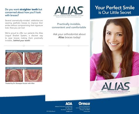 Lingual Braces Invisalign Ramstein Dillon Orthodontic Care