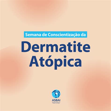 Dermatite Atópica Causas Sintomas e Tratamentos ASBAI