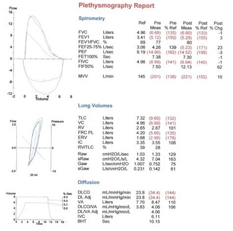 Southwest Journal Of Pulmonary Critical Care And Sleep Imaging April 2024 Medical Image Of