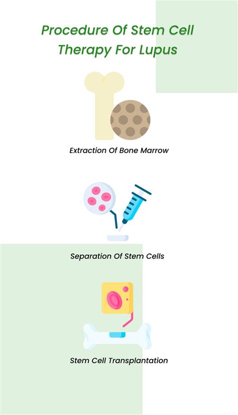 Stem Cell Therapy For Lupus 2023 All You Need To Know ClinicSpots